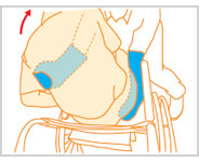 車いすへの移乗１